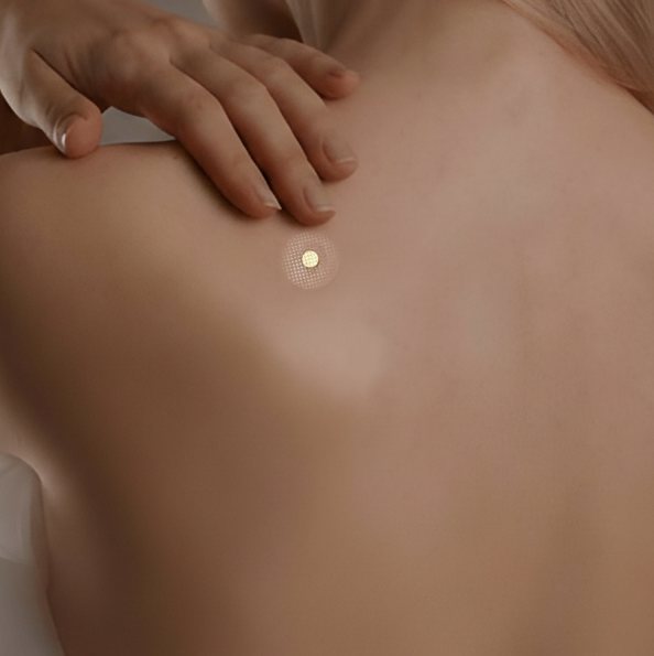 <strong>APLICA EL PARCHE</strong>